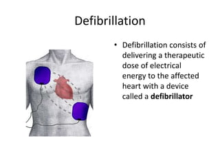 Defibrillation
• Defibrillation consists of
delivering a therapeutic
dose of electrical
energy to the affected
heart with a device
called a defibrillator
 
