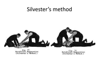 Silvester’s method
 
