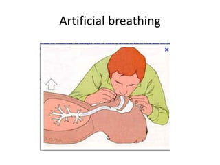 Artificial breathing
 