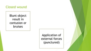 Closed wound
Blunt object
result in
contusion or
bruises
Application of
external forces
(punctured)
 