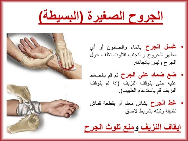 مبادئ الإسعافات الأولية First-aid-illustrated-simplified-5-638