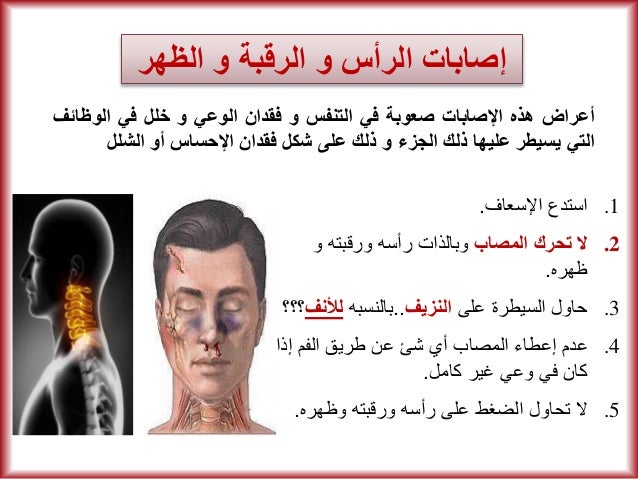 مبادئ الإسعافات الأولية First-aid-illustrated-simplified-8-638