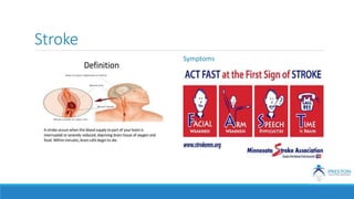 Stroke
Symptoms
 