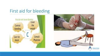 First aid for bleeding
 
