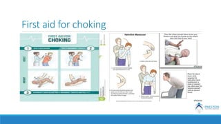 First aid for choking
 