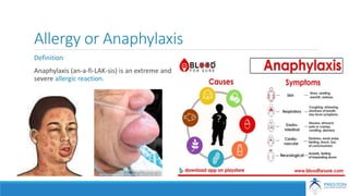 Allergy or Anaphylaxis
Definition
Anaphylaxis (an-a-fi-LAK-sis) is an extreme and
severe allergic reaction.
 