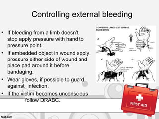 Controlling external bleeding
• If bleeding from a limb doesn’t
stop apply pressure with hand to
pressure point.
• If embedded object in wound apply
pressure either side of wound and
place pad around it before
bandaging.
• Wear gloves, if possible to guard
against infection.
• If the victim becomes unconscious
follow DRABC.
 