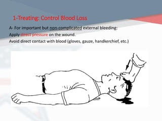 1-Treating: Control Blood Loss
A- For important but non-complicated external bleeding:
Apply direct pressure on the wound.
Avoid direct contact with blood (gloves, gauze, handkerchief, etc.)
 