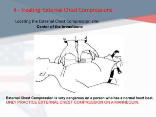 4 - Treating: External Chest Compressions
Locating the External Chest Compression site:
Center of the breastbone
External Chest Compression is very dangerous on a person who has a normal heart beat.
ONLY PRACTICE EXTERNAL CHEST COMPRESSION ON A MANNEQUIN.
 