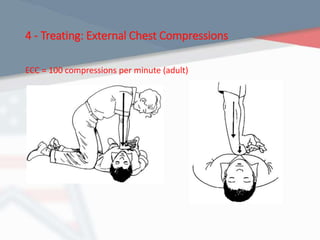 4 - Treating: External Chest Compressions
ECC = 100 compressions per minute (adult)
 