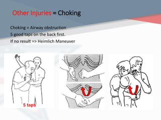 Other Injuries = Choking
Choking = Airway obstruction
5 good taps on the back first.
If no result => Heimlich Maneuver
5 taps
 