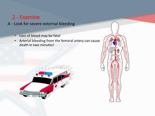 2 - Examine
A - Look for severe external bleeding
• Loss of blood may be fatal
• Arterial bleeding from the femoral artery can cause
death in two minutes!
 