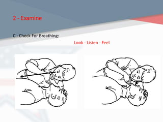 2 - Examine
C - Check For Breathing:
Look - Listen - Feel
 