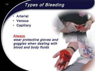 107
Always
wear protective gloves and
goggles when dealing with
blood and body fluids
Types of Bleeding
• Arterial
• Venous
• Capillary
107
© 2002 Abertay Nationwide Training
 