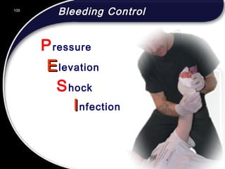 109
Bleeding Control
EElevation
Shock
IInfection
Pressure
109
© 2002 Abertay Nationwide Training
 