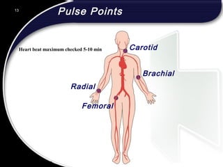 13
Pulse Points
Carotid
Brachial
Radial
Femoral
13
© 2002 Abertay Nationwide Training
Heart beat maximum checked 5-10 min
 