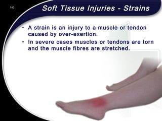 143
Soft Tissue Injuries - Strains
• A strain is an injury to a muscle or tendon
caused by over-exertion.
• In severe cases muscles or tendons are torn
and the muscle fibres are stretched.
143
© 2002 Abertay Nationwide Training
 