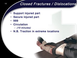 155
Closed Fractures / Dislocations
• Support injured part
• Secure injured part
• 999
• Circulation
– (10 minutes)
• N.B. Traction in extreme locations
155
© 2002 Abertay Nationwide Training
 