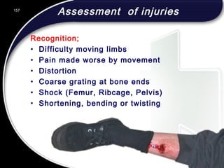 157
Assessment of injuries
Recognition;
• Difficulty moving limbs
• Pain made worse by movement
• Distortion
• Coarse grating at bone ends
• Shock (Femur, Ribcage, Pelvis)
• Shortening, bending or twisting
157
© 2002 Abertay Nationwide Training
 