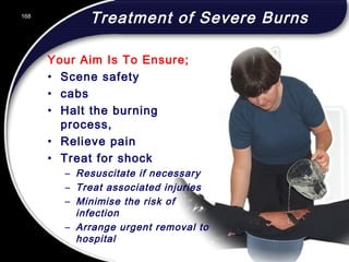 168
Treatment of Severe Burns
Your Aim Is To Ensure;
• Scene safety
• cabs
• Halt the burning
process,
• Relieve pain
• Treat for shock
– Resuscitate if necessary
– Treat associated injuries
– Minimise the risk of
infection
– Arrange urgent removal to
hospital
168
© 2002 Abertay Nationwide Training
 
