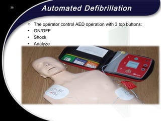 Automated Defibrillation
o The operator control AED operation with 3 top buttons:
• ON/OFF
• Shock
• Analyze
36
 