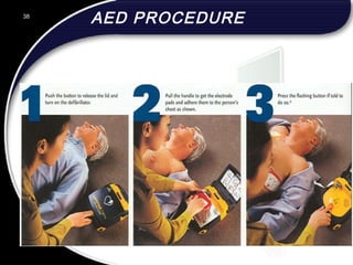 AED PROCEDURE38
 