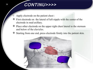 CONTINU>>>>
o Apply electrode on the patient chest :
 First electrode on the lateral of left nipple with the center of the
electrode in med axillary.
 Place other electrode on the upper right chest lateral to the sternum
and below of the clavicles.
 Starting from one end, press electrode firmly into the patient skin.
39
 