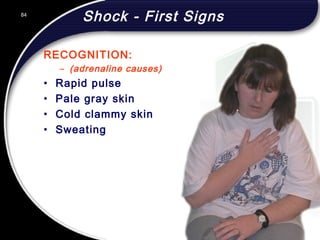 84
Shock - First Signs
RECOGNITION:
– (adrenaline causes)
• Rapid pulse
• Pale gray skin
• Cold clammy skin
• Sweating
84
© 2002 Abertay Nationwide Training
 