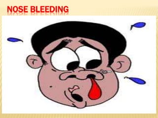 NOSE BLEEDING
 