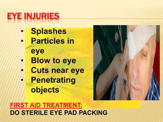 EYE INJURIES
• Splashes
• Particles in
eye
• Blow to eye
• Cuts near eye
• Penetrating
objects
FIRST AID TREATMENT:
DO STERILE EYE PAD PACKING
 