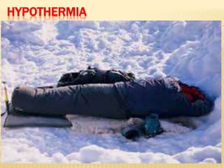 HYPOTHERMIA
 