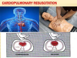 CARDIOPULMONARY RESUSCITATION
 