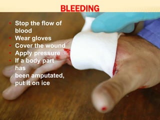 BLEEDING
• Stop the flow of
blood
• Wear gloves
• Cover the wound
• Apply pressure
• If a body part
has
been amputated,
put it on ice
 