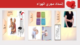 ‫الهواء‬ ‫مجري‬ ‫إنسداد‬
 