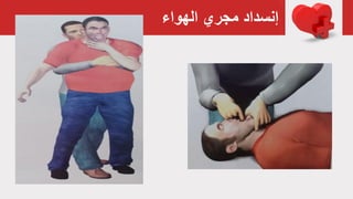 ‫الهواء‬ ‫مجري‬ ‫إنسداد‬
 