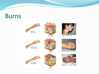 First AID | PPTX