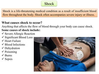 Shock
What causes shock to occur?
Anything that affects the flow of blood through your body can cause shock.
Some causes of shock include:
 Severe Allergic Reaction
 Significant Blood Loss
 Heart Failure
 Blood Infections
 Dehydration
 Poisoning
 Burns
 Sepsis
Shock is a life-threatening medical condition as a result of insufficient blood
flow throughout the body. Shock often accompanies severe injury or illness.
 