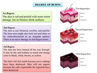 DEGREE OF BURNS
1st Degree
The skin is red and painful with some minor
damage, but no blisters; think sunburn.
2nd Degree
The skin is red, blistered, swollen, and painful.
The burn area might also look wet and shiny or
be white/discolored in an irregular pattern.
There is no nerve damage in 2nd degree burns.
3rd Degree
The skin has been burned all the way through.
It may be dry and leathery to touch and change
color to black, white, brown, or yellow.
The burn will feel numb because nerve endings
have been destroyed. Skin will not regrow
because the cells responsible for regrowth have
been destroyed.
 