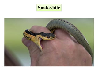 Snake-bite
 