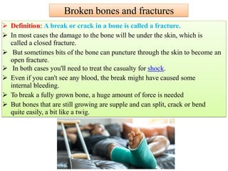 Broken bones and fractures
 Definition: A break or crack in a bone is called a fracture.
 In most cases the damage to the bone will be under the skin, which is
called a closed fracture.
 But sometimes bits of the bone can puncture through the skin to become an
open fracture.
 In both cases you'll need to treat the casualty for shock.
 Even if you can't see any blood, the break might have caused some
internal bleeding.
 To break a fully grown bone, a huge amount of force is needed
 But bones that are still growing are supple and can split, crack or bend
quite easily, a bit like a twig.
 