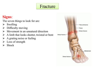 Fracture
Signs:
The seven things to look for are:
 Swelling
 Difficulty moving
 Movement in an unnatural direction
 A limb that looks shorter, twisted or bent
 A grating noise or feeling
 Loss of strength
 Shock
 