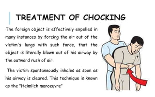 TREATMENT OF CHOCKING
The foreign object is effectively expelled in
many instances by forcing the air out of the
victim's lungs with such force, that the
object is literally blown out of his airway by
the outward rush of air.
The victim spontaneously inhales as soon as
his airway is cleared. This technique is known
as the "Heimlich manoeuvre"
 
