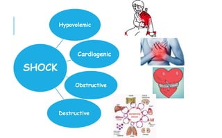 Hypovolemic
Cardiogenic
Obstructive
Destructive
SHOCK
 
