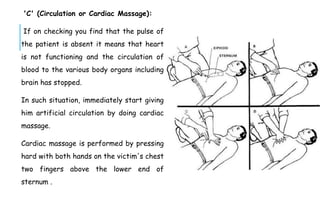 'C' (Circulation or Cardiac Massage):
If on checking you find that the pulse of
the patient is absent it means that heart
is not functioning and the circulation of
blood to the various body organs including
brain has stopped.
In such situation, immediately start giving
him artificial circulation by doing cardiac
massage.
Cardiac massage is performed by pressing
hard with both hands on the victim's chest
two fingers above the lower end of
sternum .
 