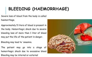 BLEEDING (HAEMORRHAGE)
Severe loss of blood from the body is called
haemorrhage.
Approximately 5 liters of blood is present in
the body. Hemorrhagic shock due to severe
bleeding loss of more than 1 liter of blood
may put the life of the patient in danger.
Bleeding may lead to 'anaemia.
The patient may go into a stage of
hemorrhagic shock due to excessive blood
Bleeding may be internal or external
 