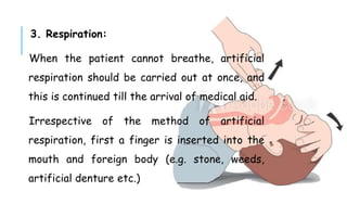3. Respiration:
When the patient cannot breathe, artificial
respiration should be carried out at once, and
this is continued till the arrival of medical aid.
Irrespective of the method of artificial
respiration, first a finger is inserted into the
mouth and foreign body (e.g. stone, weeds,
artificial denture etc.)
 