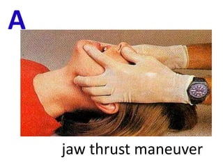A
jaw thrust maneuver
 