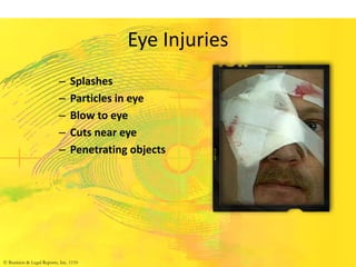 Eye Injuries
– Splashes
– Particles in eye
– Blow to eye
– Cuts near eye
– Penetrating objects
© Business & Legal Reports, Inc. 1110
 