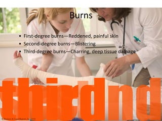 Burns
• First-degree burns—Reddened, painful skin
• Second-degree burns—Blistering
• Third-degree burns—Charring, deep tissue damage
© Business & Legal Reports, Inc. 1110
 