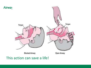 Airway
This action can save a life!
 